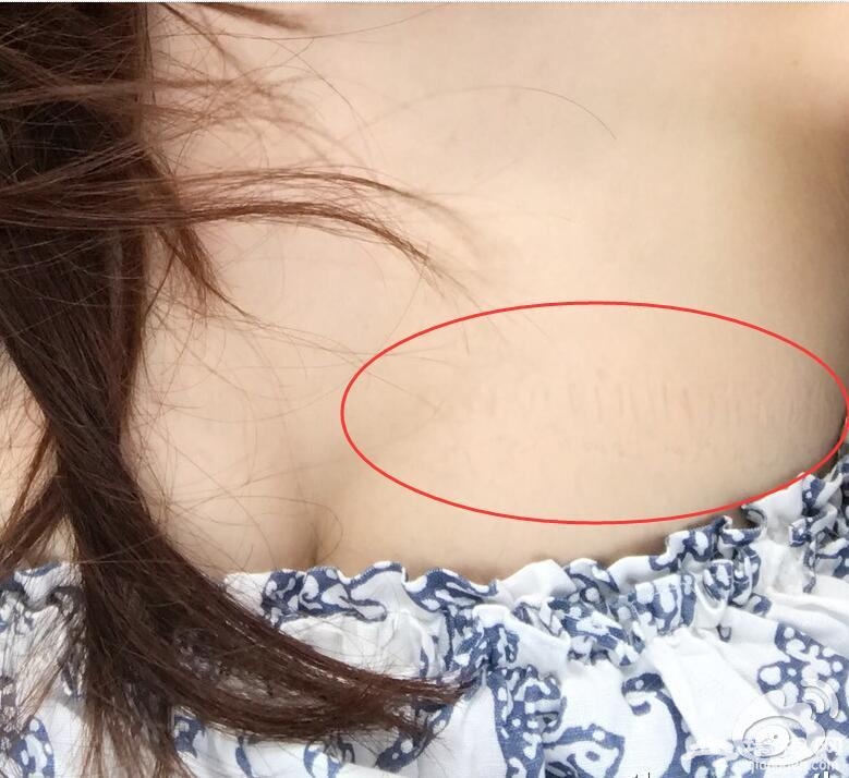熊黛林好心机！拍照时故意把衣服往下扯，网友一下就发现了！[墙根网]
